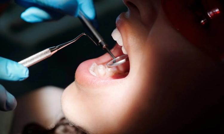 Marquage laser et industrie dentaire